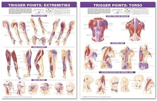Plakátsorozat - Az emberi test trigger pontjai
